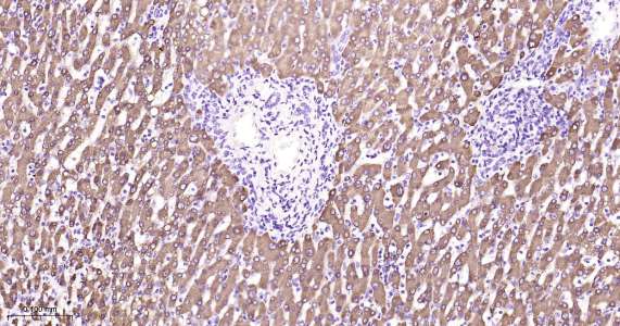 Human Cyclooxygenase 2 Ready-To-Use IHC Kit (免疫组化试剂盒) - IHC-P | Bioss